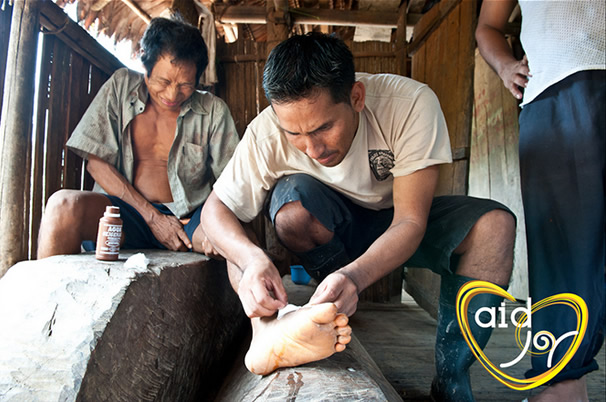 Cesar Peña disinfecting a painful abscess in the Amazon.